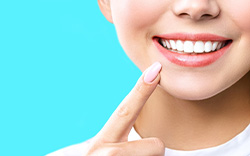 smiling woman teeth whitening in San Antonio 