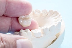 Dental crown held in fingertips
