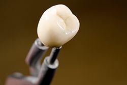Dental crown fabricated in lab