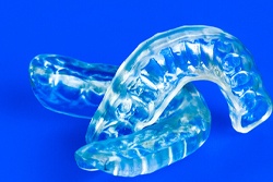 Customized mouthguards for protection in San Antonio