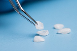 veneers on table in San Antonio