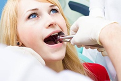 Young woman having tooth removed